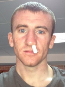 Irish boxer Paddy Barnes to miss Euro final with a broken nose